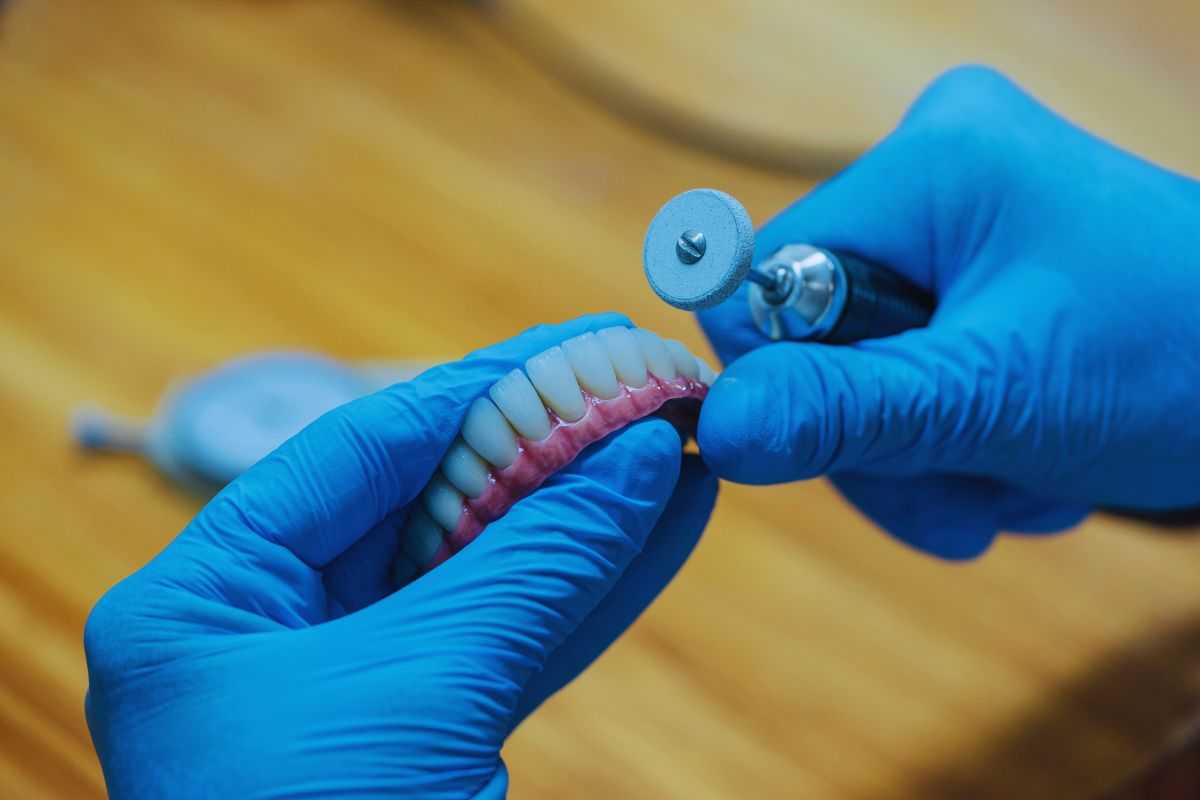 Protesi dentaria in mano ad un odontotecnico
